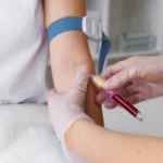 Comparación de catéter venoso central y periférico usados en hospitales de Guatemala